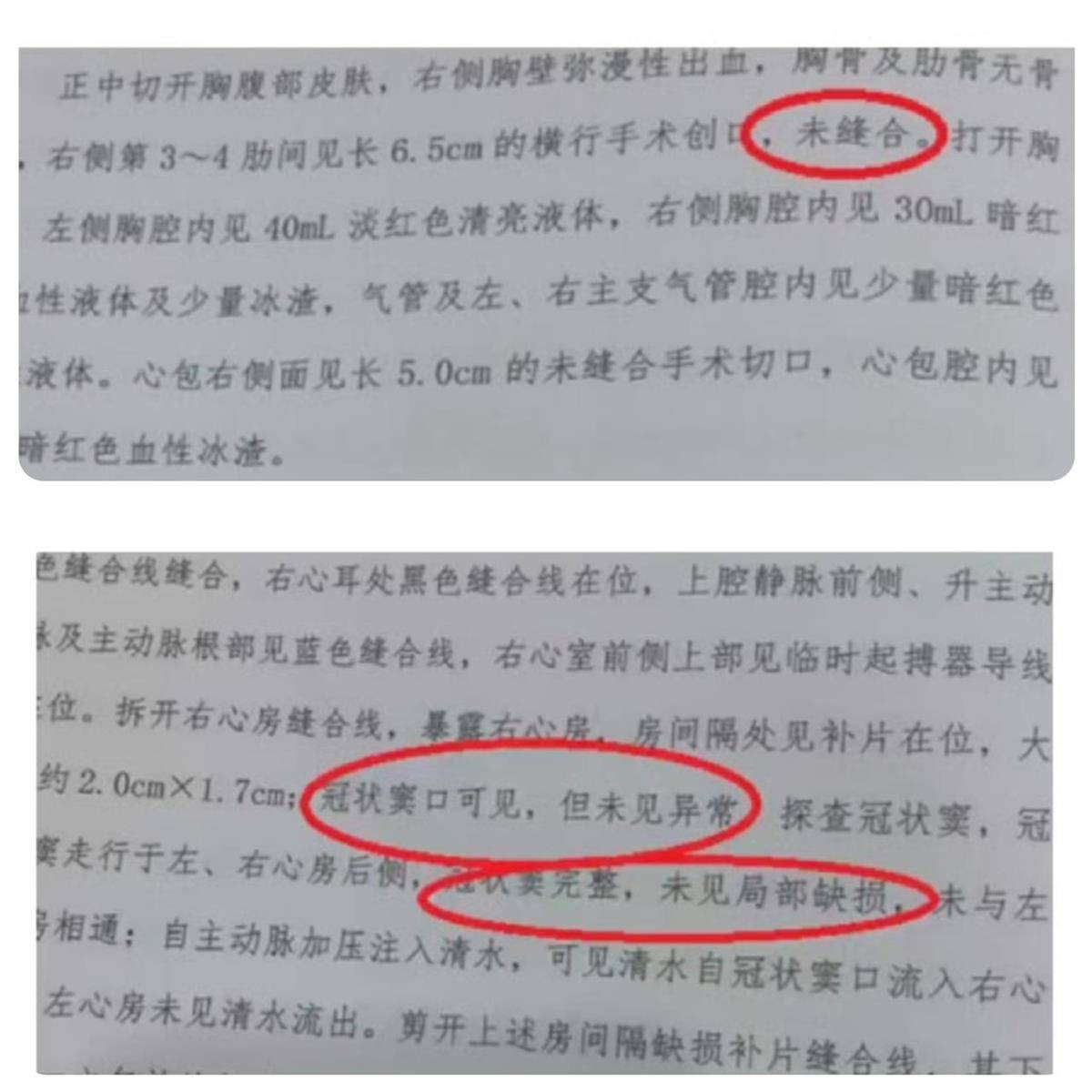 皇冠信用网登2_宁波夭折女婴小洛熙部分尸检报告公布皇冠信用网登2，显示6.5厘米创口未缝合，父亲：会择期公布完整报告